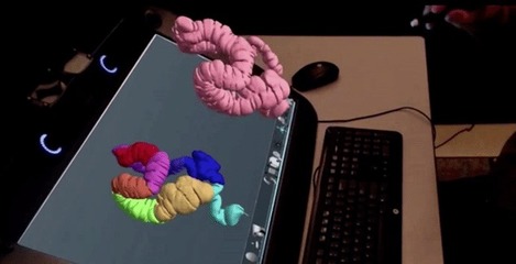 精準醫(yī)療新篇章 3D打印與虛擬現(xiàn)實融合開創(chuàng)外科手術新紀元